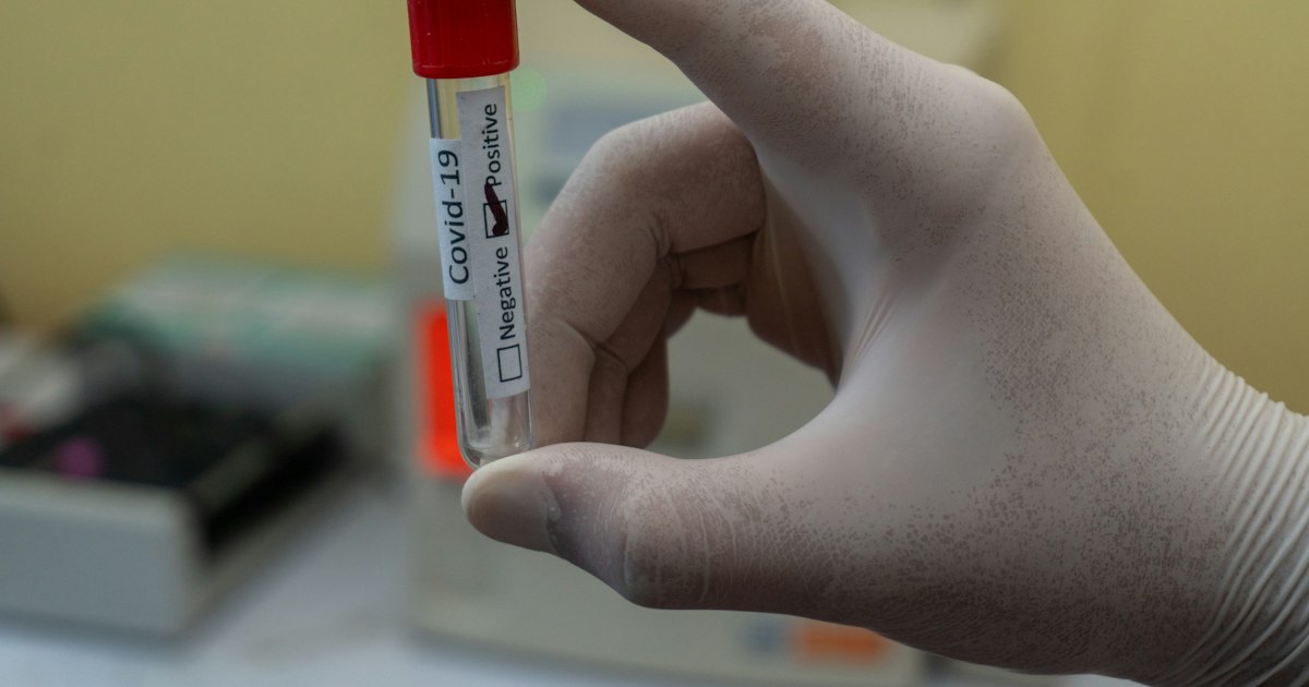 How to prepare for the ‘Free testosterone’ test: rules for taking it