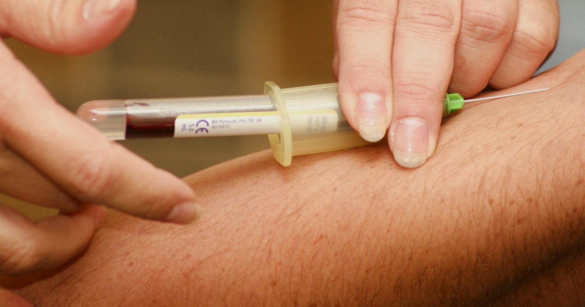 How to prepare for the ‘Estradiol’ test: rules for taking it
