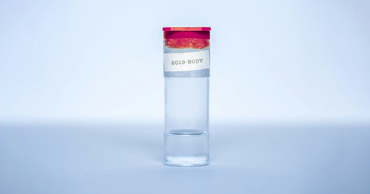 How to prepare for the ‘Prolactin’ test: rules for taking it