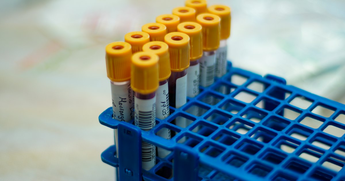 How to prepare for the ‘Progesterone’ test: rules for taking it